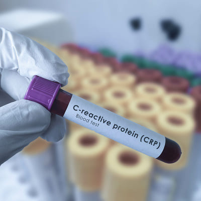 PCR